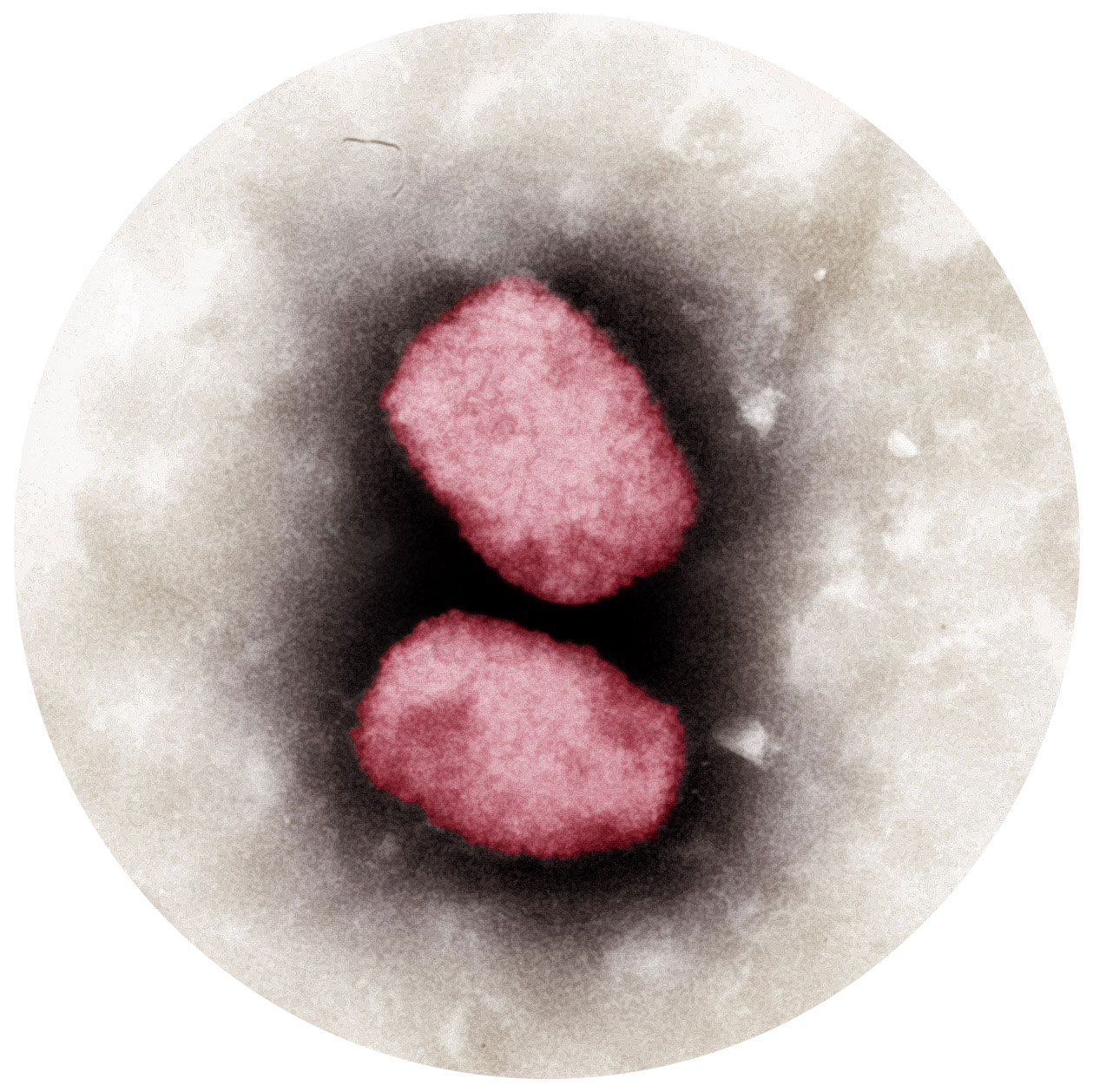 Mpox / MPXV (früher Affenpocken)